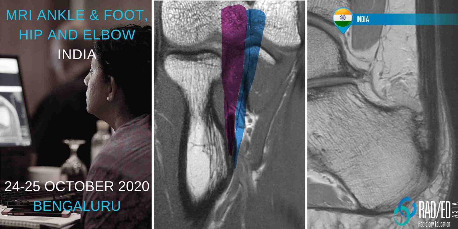 BLHAE20Oct mri msk learn radiology online mri ankle radedasia
