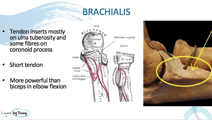 brachioradialis tendon