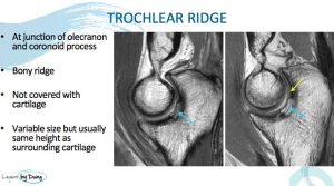 Elbow Joints Normal Variants on MRI - Radedasia