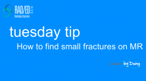 mri fracture how to find tuesday tip radiology education asia