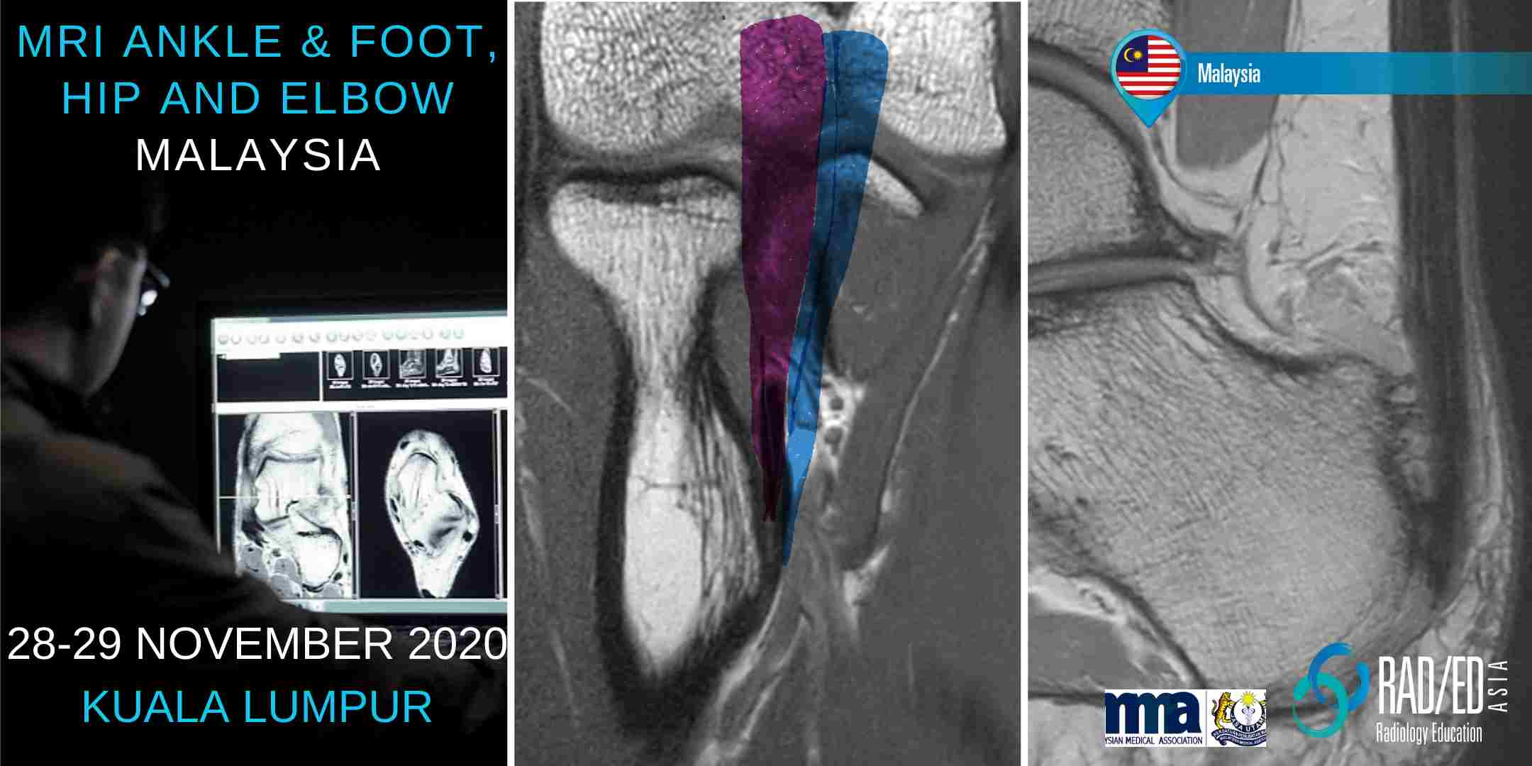 KLHAE20Nov mri msk online radiology online mri ankle radedasia