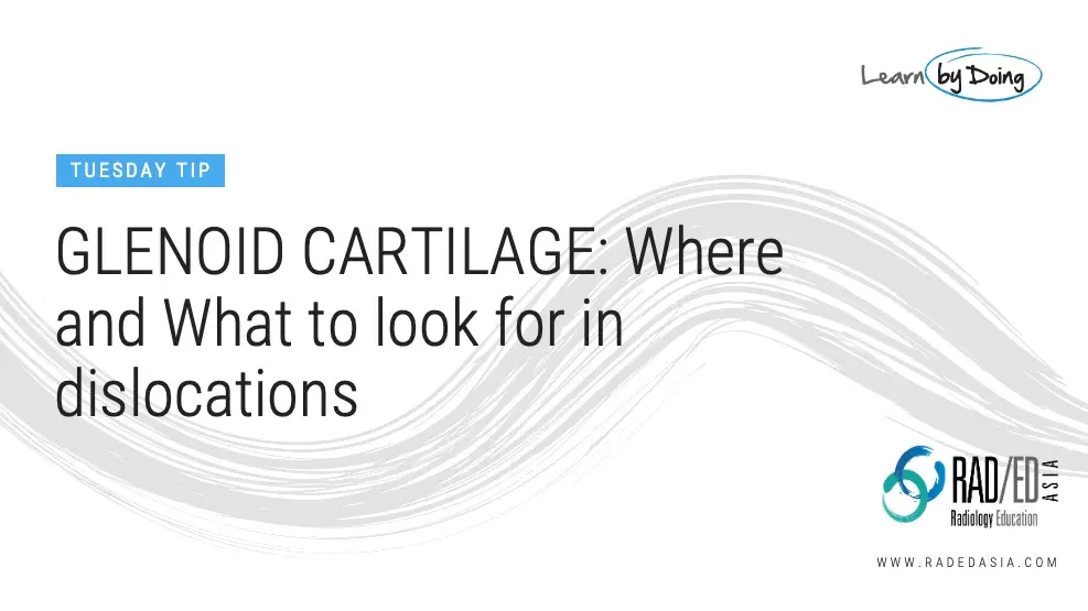 shoulder cartilage glenoid dislocation radiology education asia tuesday tip