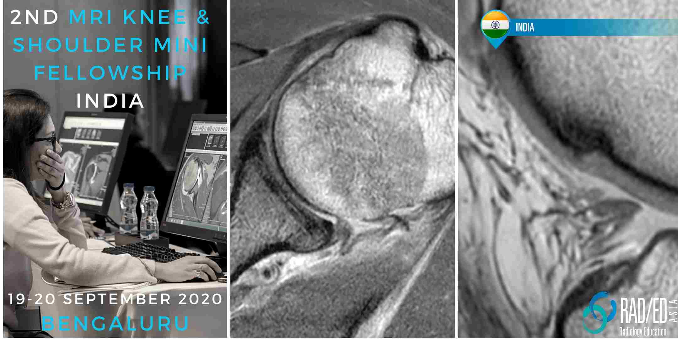 BLKS20Sep bengaluru mri knee shoulder mini fellowship workshop radiology conference india