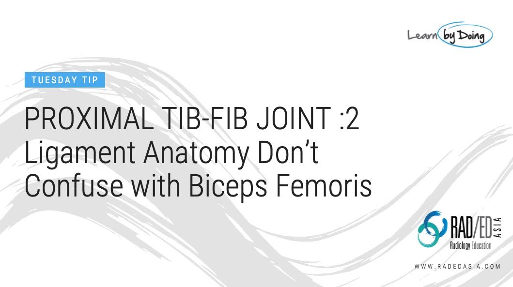 proximal tibio fibular joint mri normal anatomy ligaments biceps femoris online radiology courses conference education asia