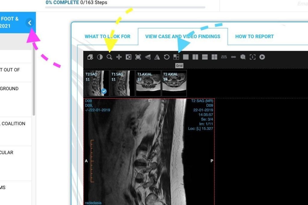 dicom-viewer-to-magnify-radedasia