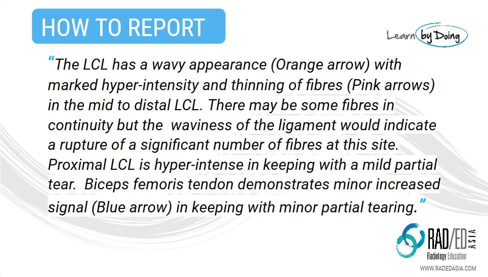 OLK 19.1 case 2 how to rrpt mri knee rea