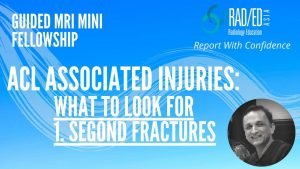 acl tear mri segond fracture radiology education asia online radiology mri course