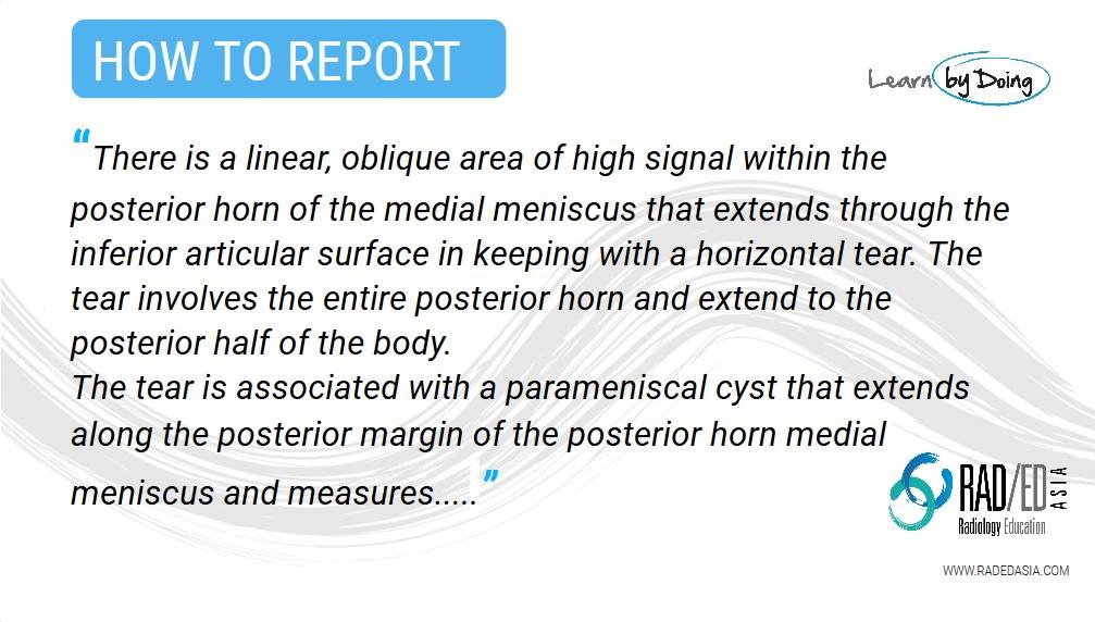 olk 3.1 case 1 how to report knee mri rea