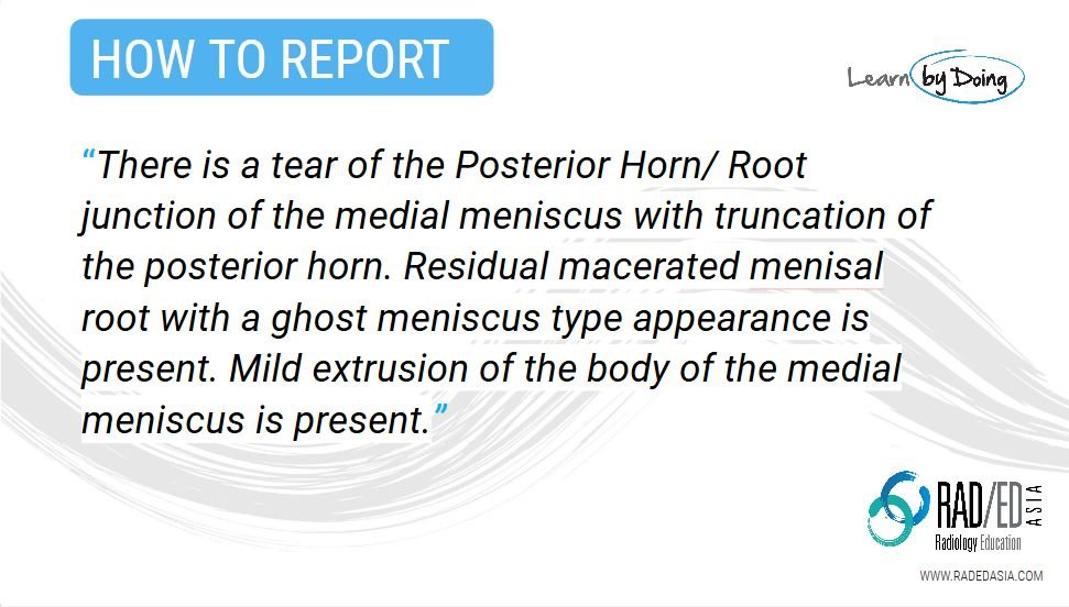 olk 7.2 case 2a how to report knee mri rea