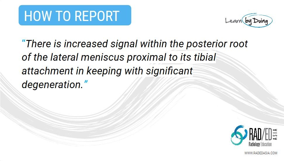 olk 7.2 case 2b how to report knee mri rea