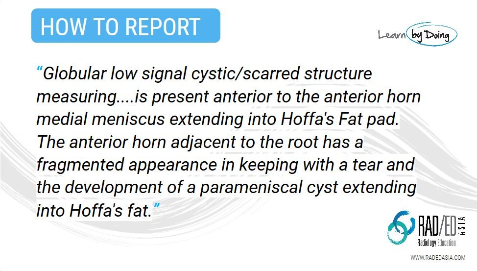olk 7.2 case 2c how to report knee mri rea