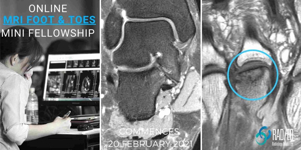 online radiology course mri foot and toes radedasia