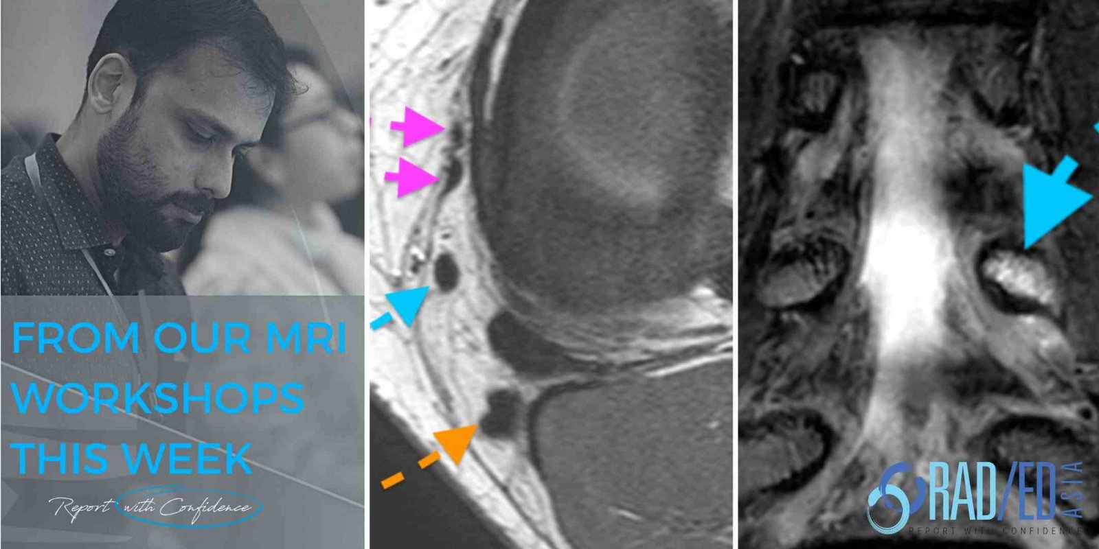 MSK MRI COURSES KEY POINTS FROM OUR MSK MRI COURSES Radedasia