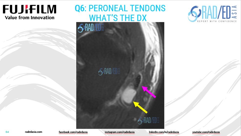 fujifilm web msk series 2 tendons Q6 radedasia