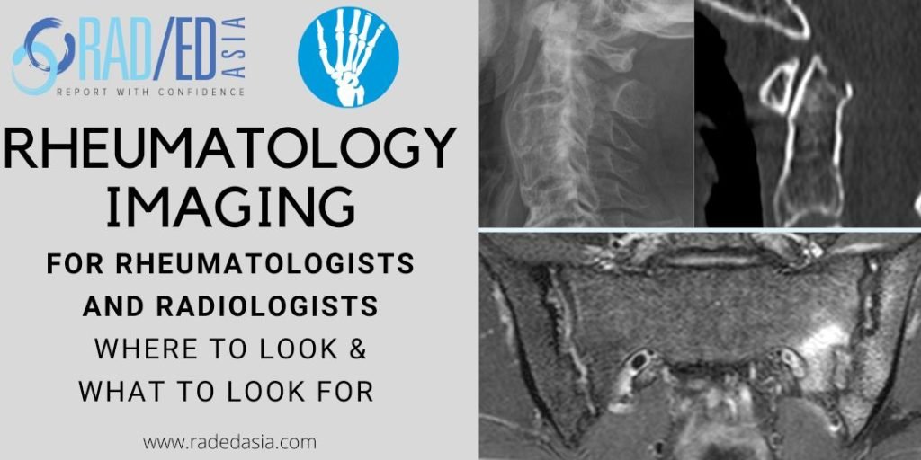 Imaging Rheumatology Radiology MRI Rheumatologists radedasia
