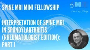 MRI Spine Rheumatologist rheumatology Ankylosing Spondylitis Spondyloarthropathy radedasia