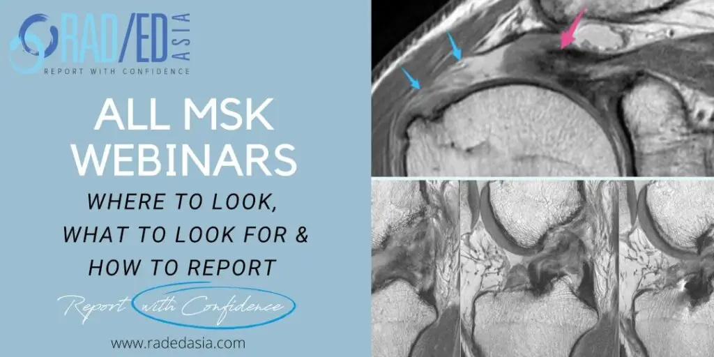 msk-webinar-musculoskeletal-mri-webinar-online