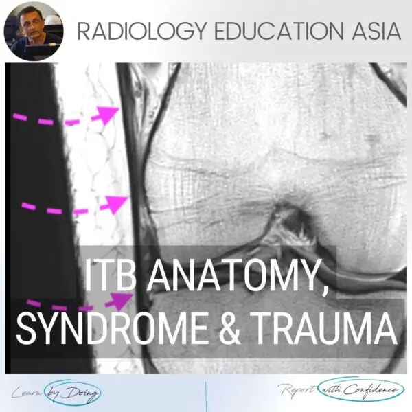 iliotibial band mri anatomy syndrome trauma mri knee radedasia