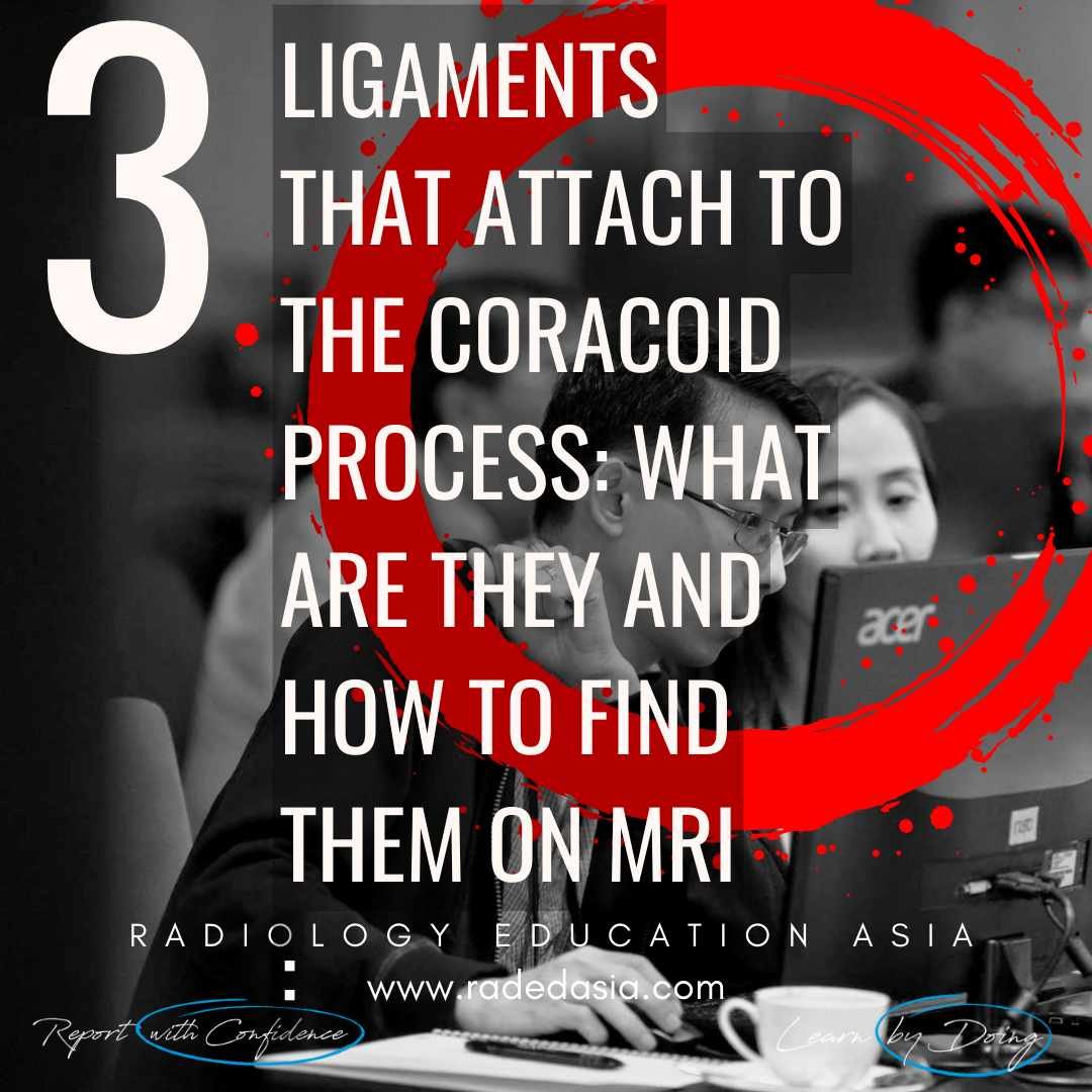 ligaments attached to the coracoid process mri shoulder