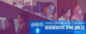 spine-degeneration-mri-online-course-sij-degenerative-disease-radiology-radedasia