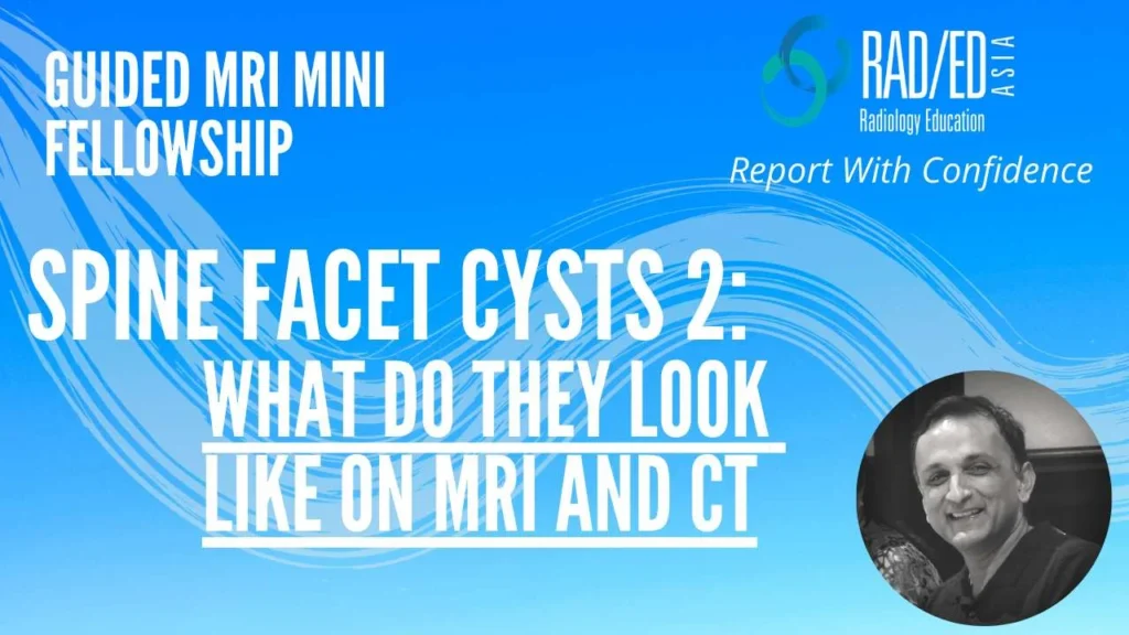 ct mri facet cysts mri spine how to mri facet cysts spine learn spine mri online radiology education asia