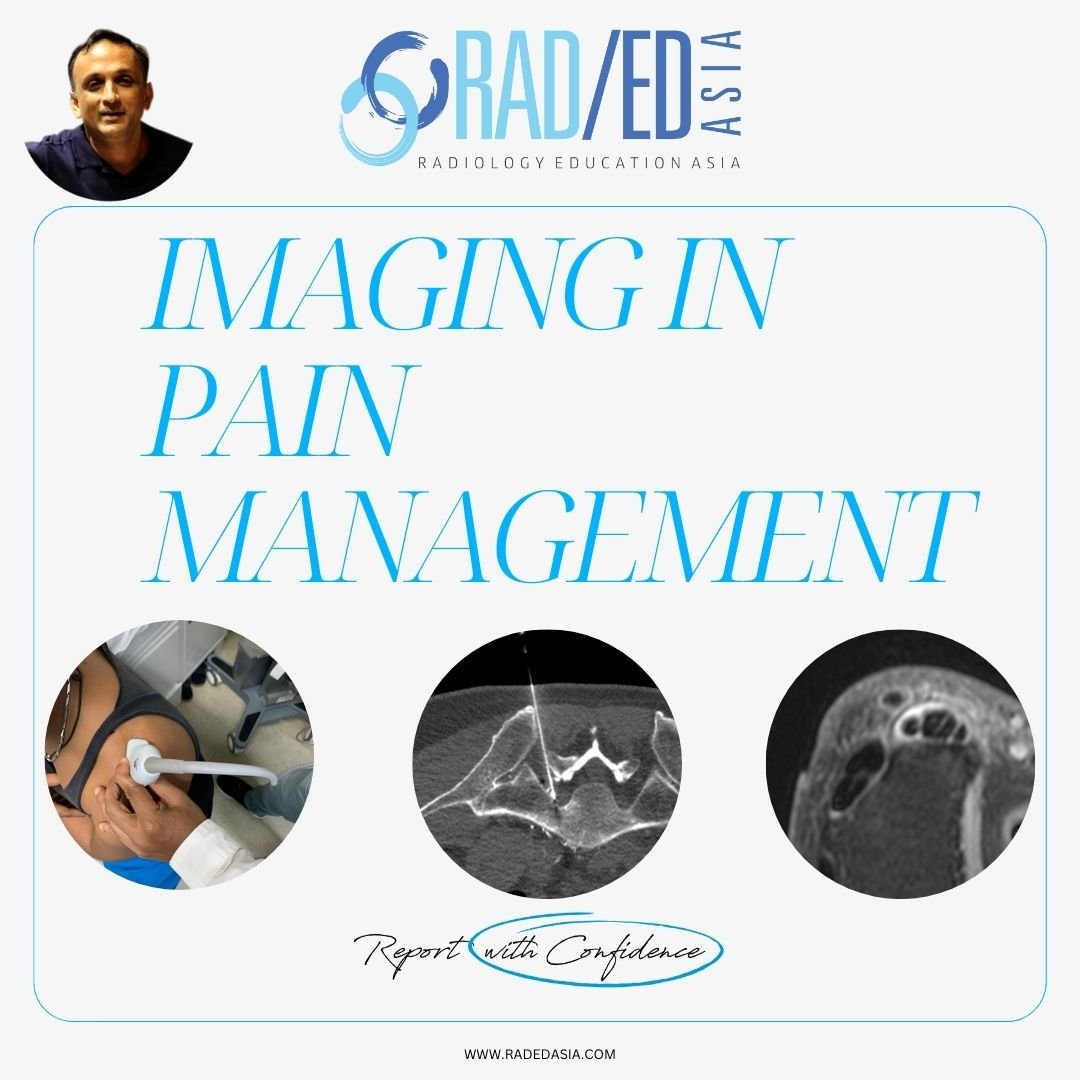 Imaging in Pain Management. What to look for in CT MRI and Ultrasound