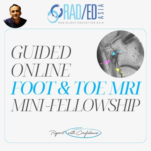 ONLINE GUIDED MSK MRI FOOT & TOES MINI-FELLOWSHIP COURSE