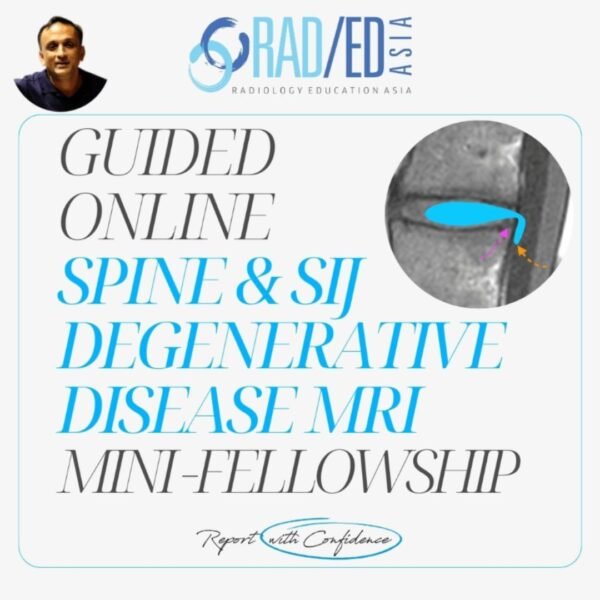 ONLINE GUIDED MRI SPINE MINI-FELLOWSHIP DEGENERATIVE SPINE AND SIJ COURSE