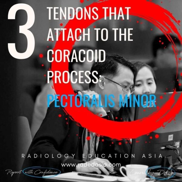 Coracoid process tendon attachments, including the pectoralis minor insertion and key anatomical landmarks.