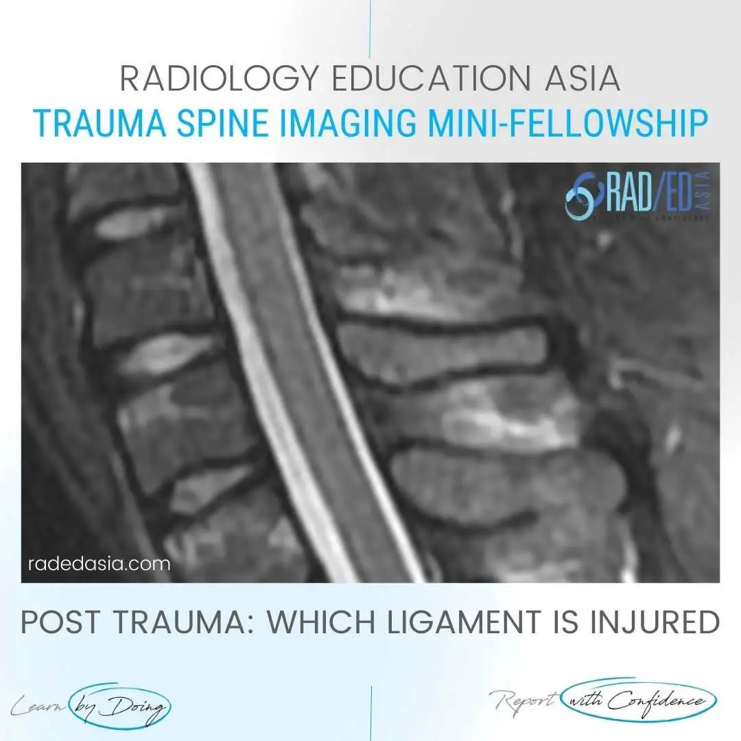 spine-ligaments-mri-injury-radiology-interspinous-trauma.jpg