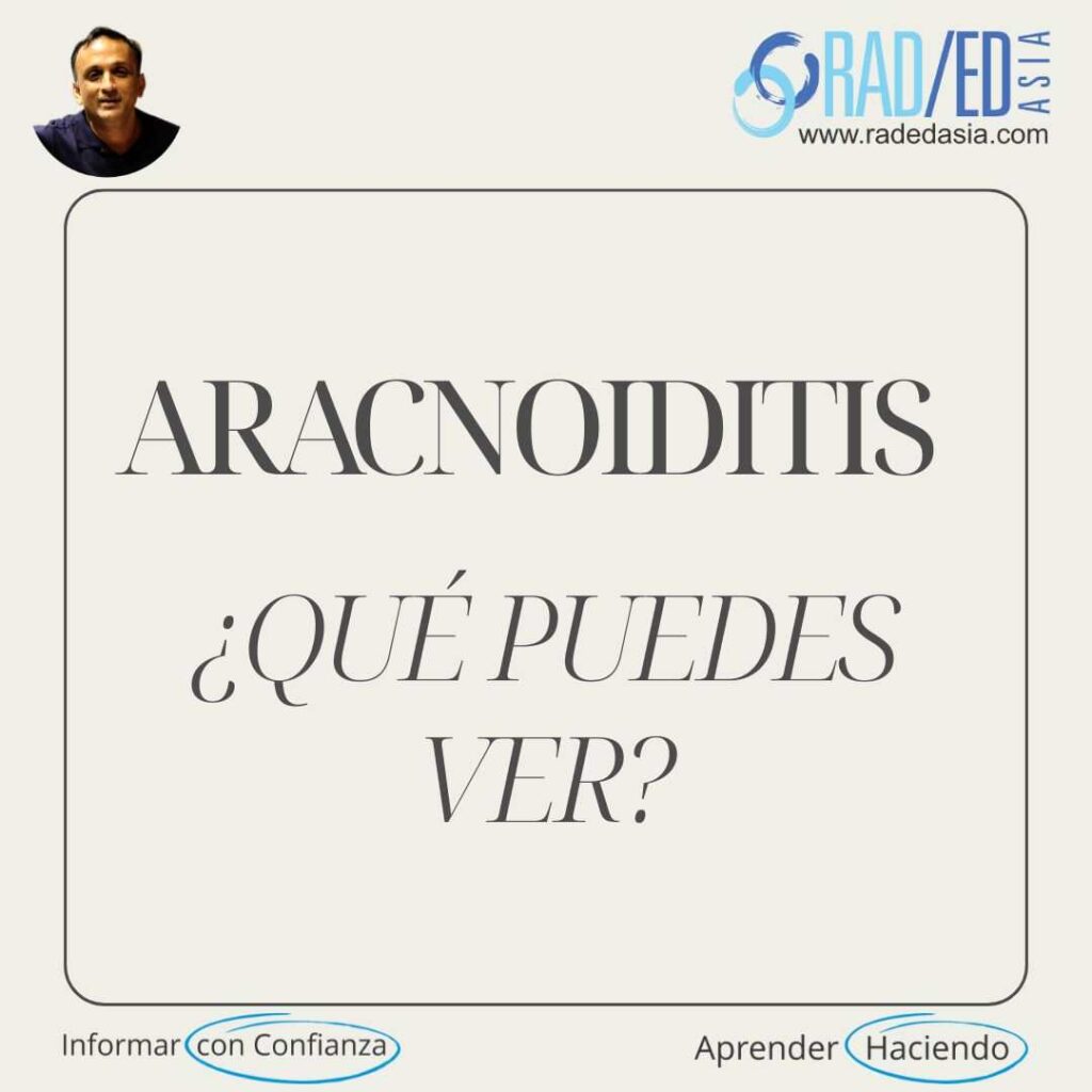 aracnoiditis resonancia magnética