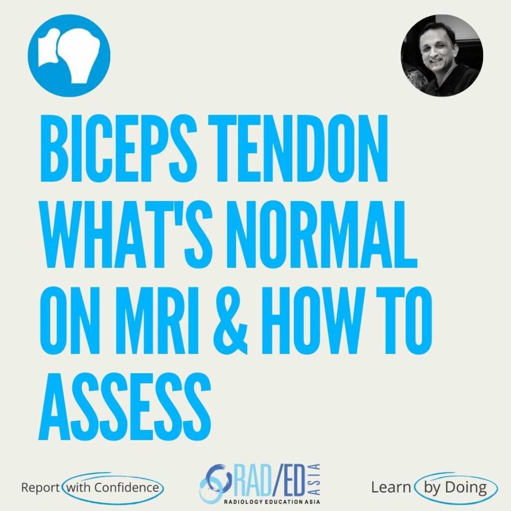 MRI Shoulder Biceps tendon Normal MRI and how to assess it.