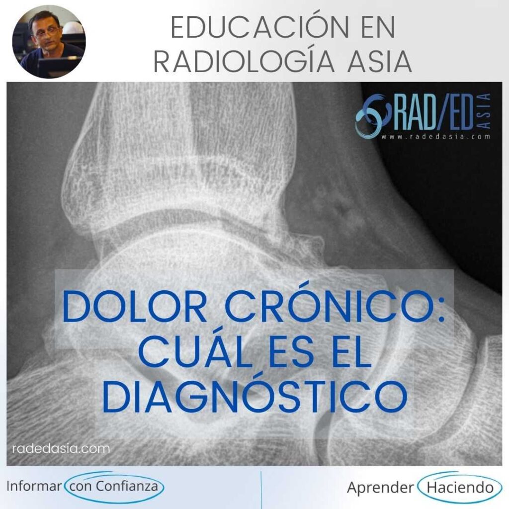 pinzamiento de tobillo radiología anterior radiografía resonancia magnética radedasia