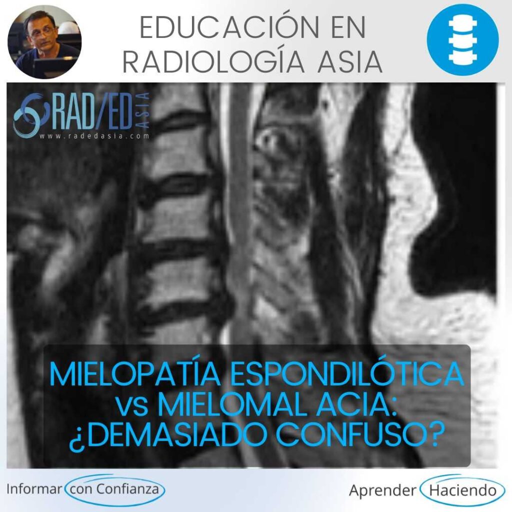 mielomalacia-espondilótica-mielopatía-radiología-educación-asia