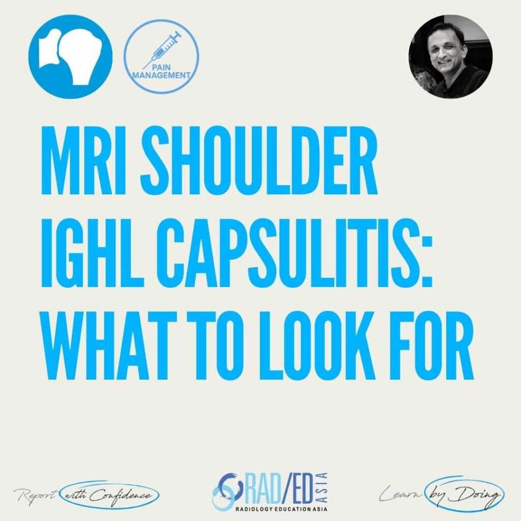 Shoulder MRI IGHL (inferior glenohumeral ligament) capsulitis, Frozen Shoulder on MRI. What to look for.