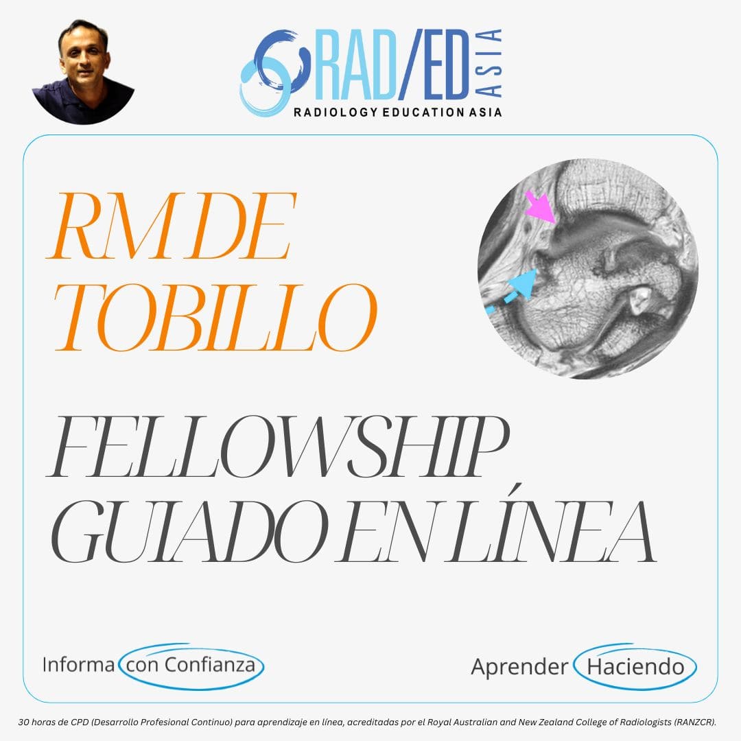 Fellowship guiada en línea sobre RM de Tobillo impartida por Radiology Education Asia con acreditación CPD (Desarrollo Profesional Continuo).