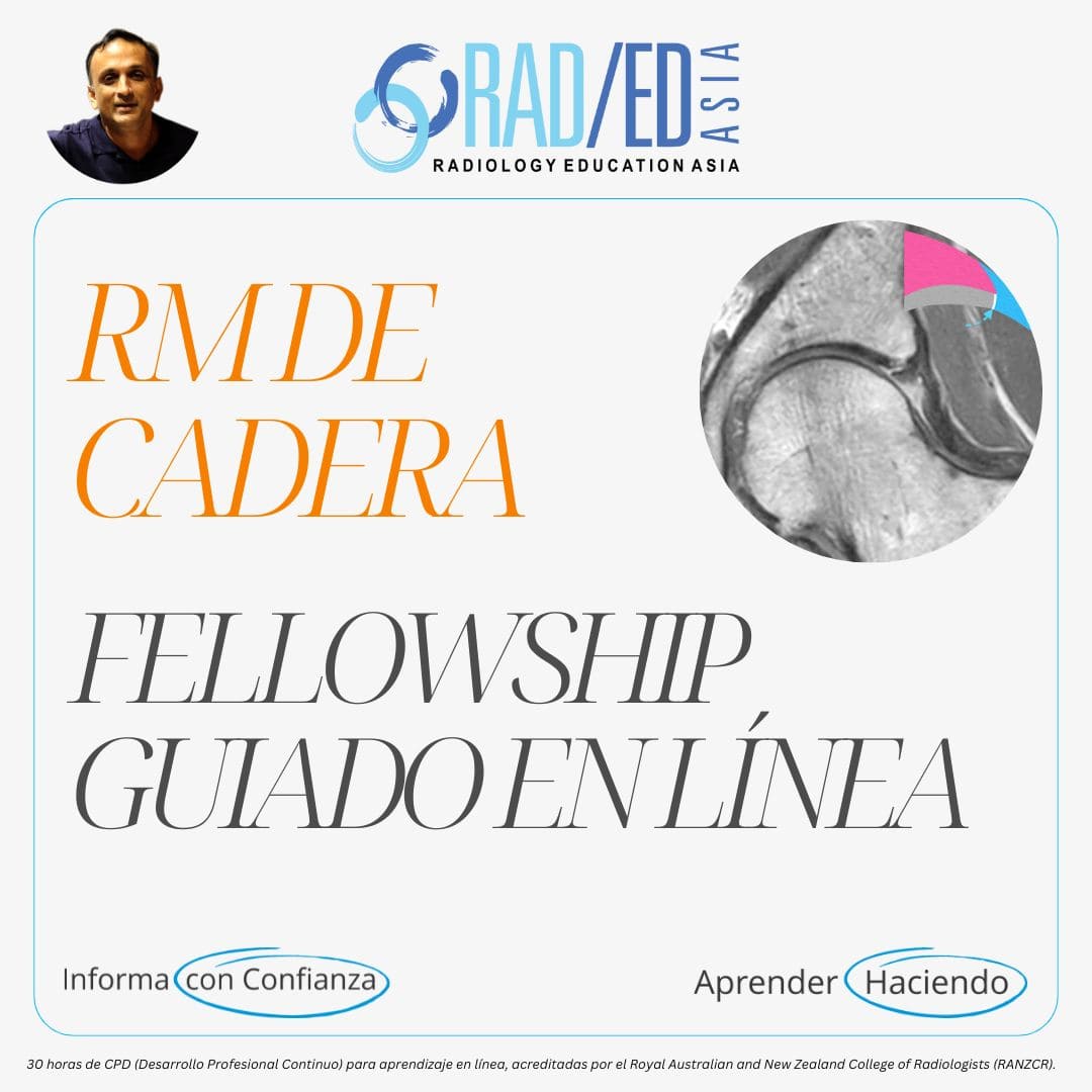 Fellowship guiada en línea sobre RM de Cadera impartida por Radiology Education Asia con acreditación CPD (Desarrollo Profesional Continuo).