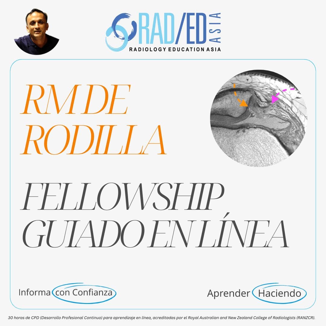 Fellowship guiada en línea sobre RM de rodilla impartida por Radiology Education Asia con acreditación CPD (Desarrollo Profesional Continuo).