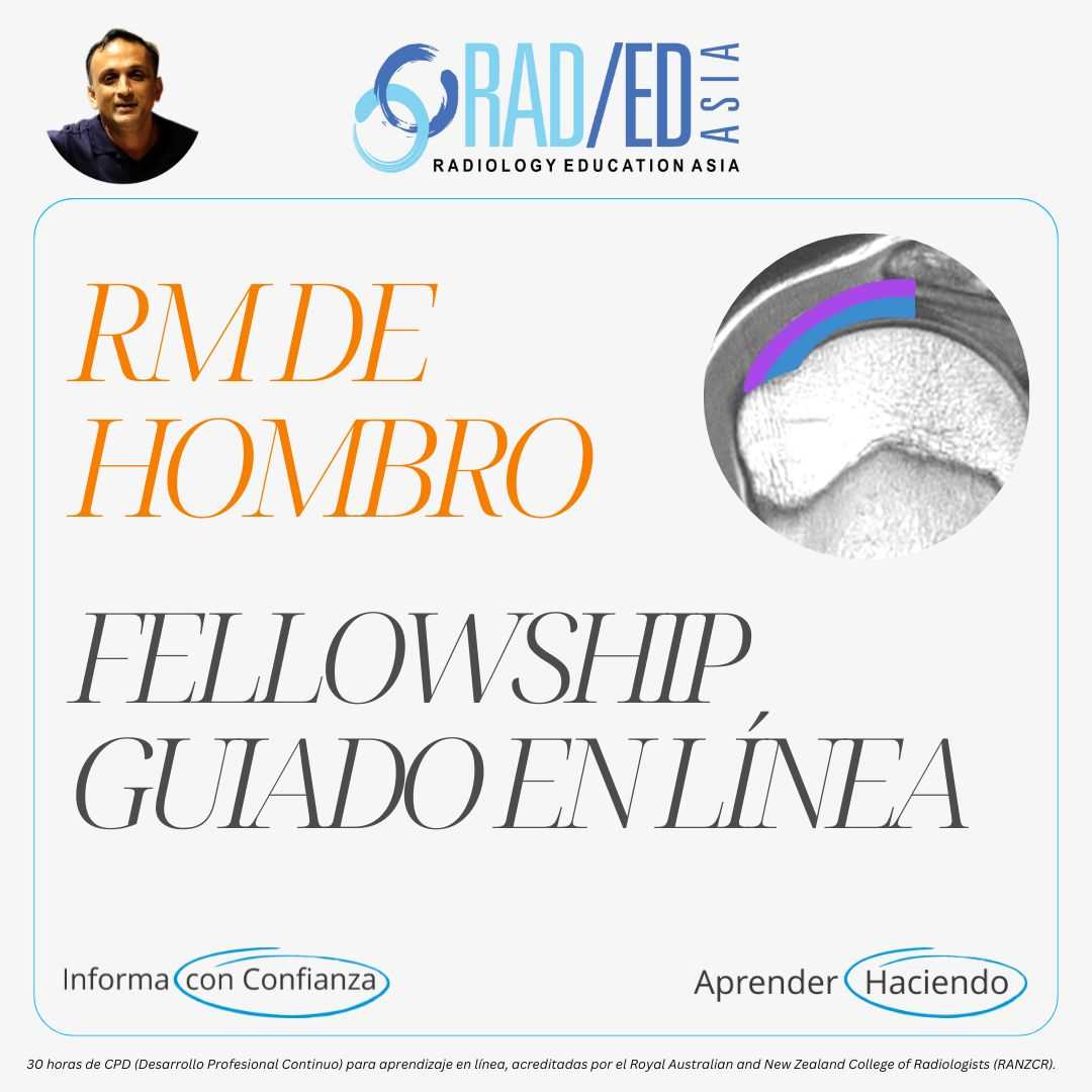 Fellowship guiada en línea sobre RM de hombro impartida por Radiology Education Asia con acreditación CPD.