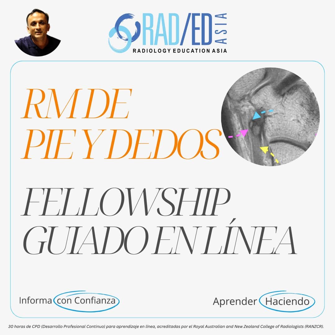 Fellowship guiada en línea sobre RM de Pie y Dedos impartida por Radiology Education Asia con acreditación CPD (Desarrollo Profesional Continuo).