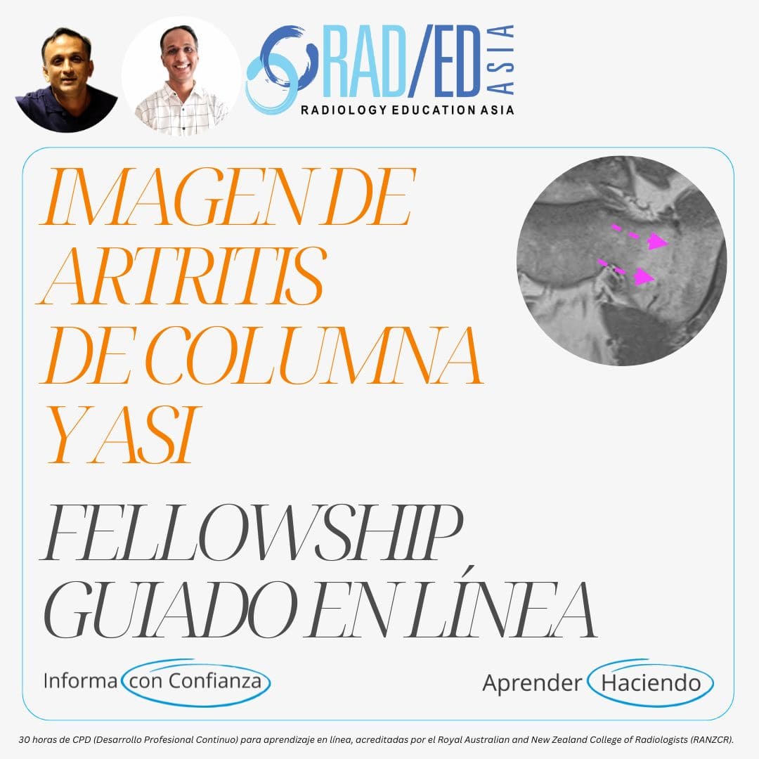 Fellowship guiada en línea sobre espondiloartritis de la columna vertebral y asi impartida por Radiology Education Asia con acreditación CPD (Desarrollo Profesional Continuo).