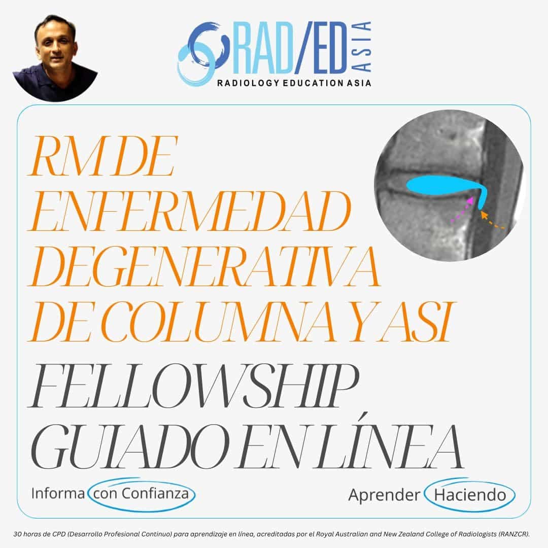 Fellowship guiada en línea sobre la enfermedad degenerativa de la columna vertebral impartida por Radiology Education Asia y acreditada por el CPD.