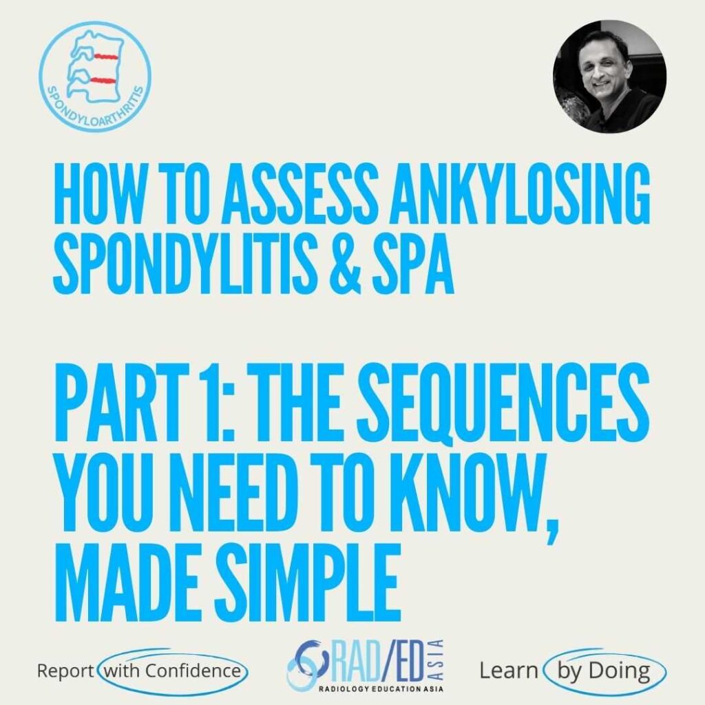 MRI spine sequences for assessing ankylosing spondylitis (AS) and spondyloarthritis (SpA).