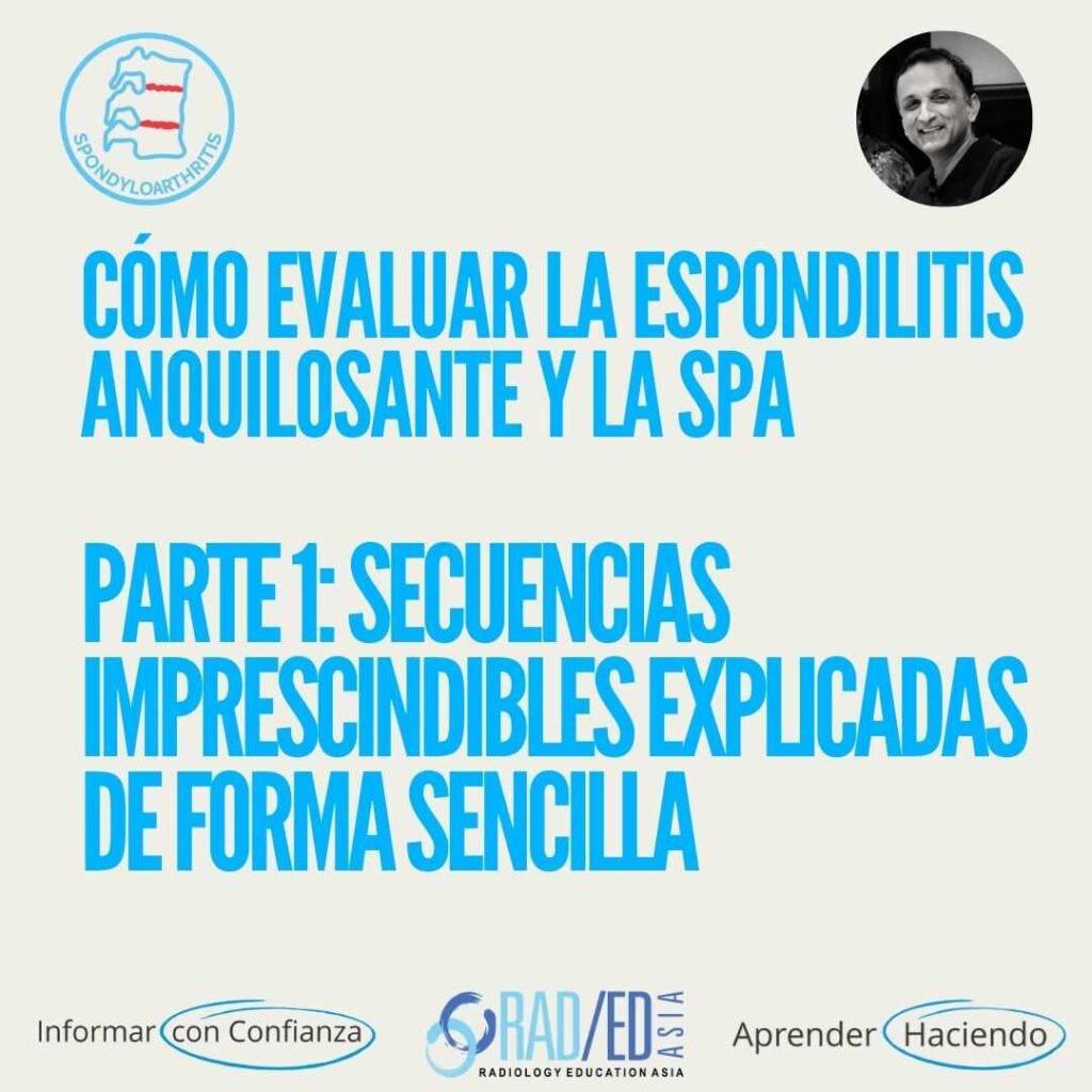 Secuencias de RM de la columna vertebral para evaluar la espondilitis anquilosante (EA) y la espondiloartritis (EPS).