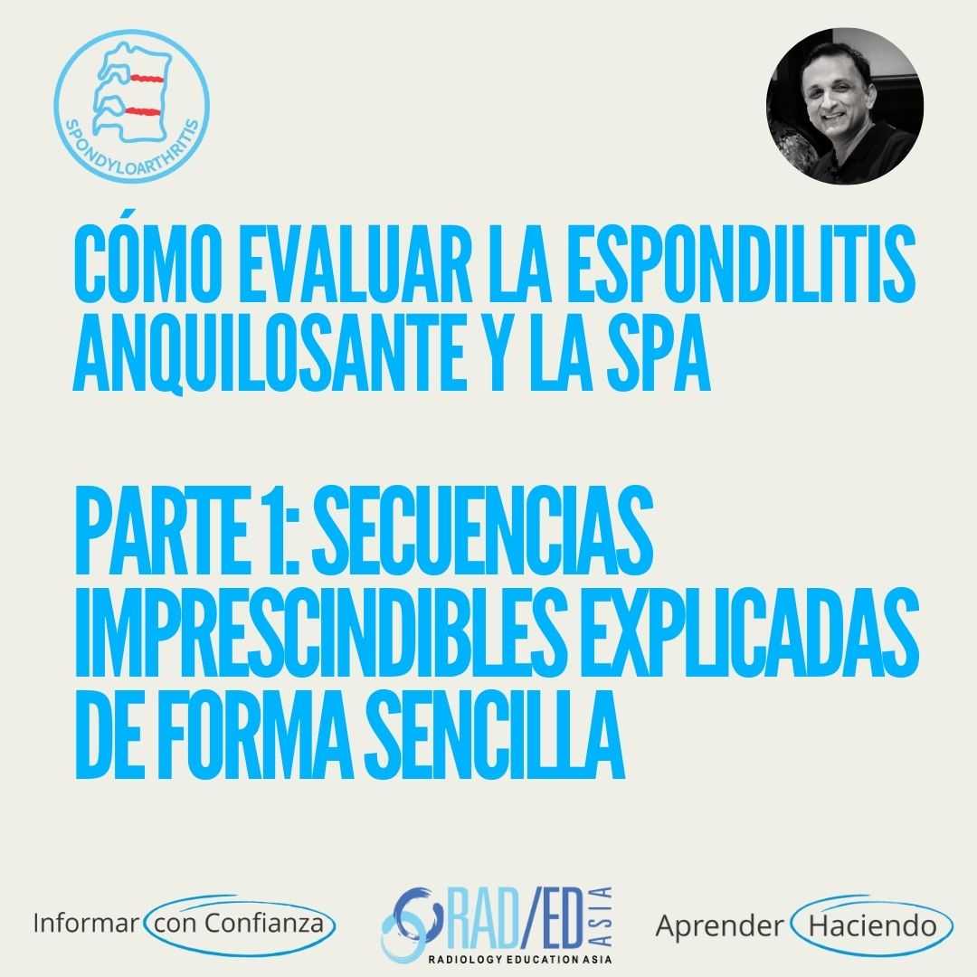 Secuencias de RM de la columna vertebral para evaluar la espondilitis anquilosante (EA) y la espondiloartritis (EPS).
