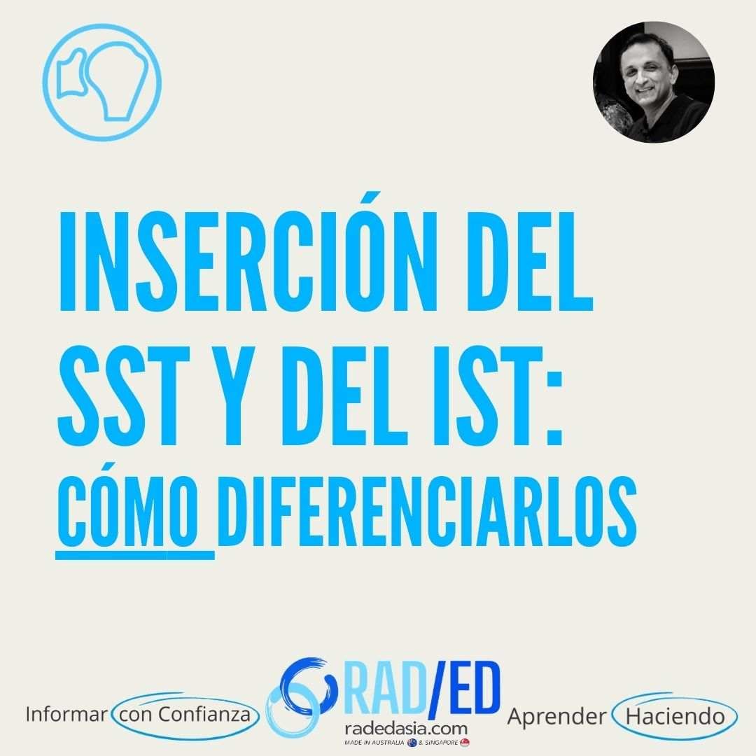 RMN de la inserción de los tendones del supraespinoso e infraespinoso del manguito rotador con orientación sobre la diferenciación entre el TSM y el TSI.