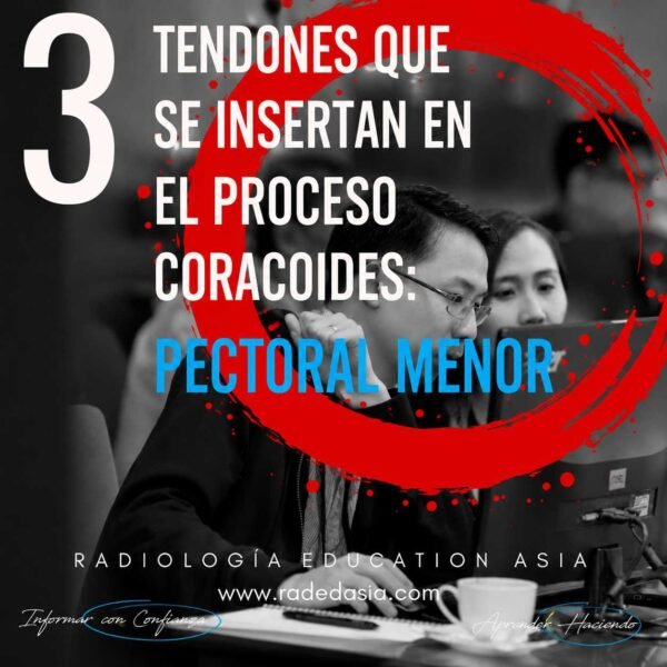 Inserciones tendinosas de la apófisis coracoides, incluida la inserción del pectoral menor y los principales reparos anatómicos.