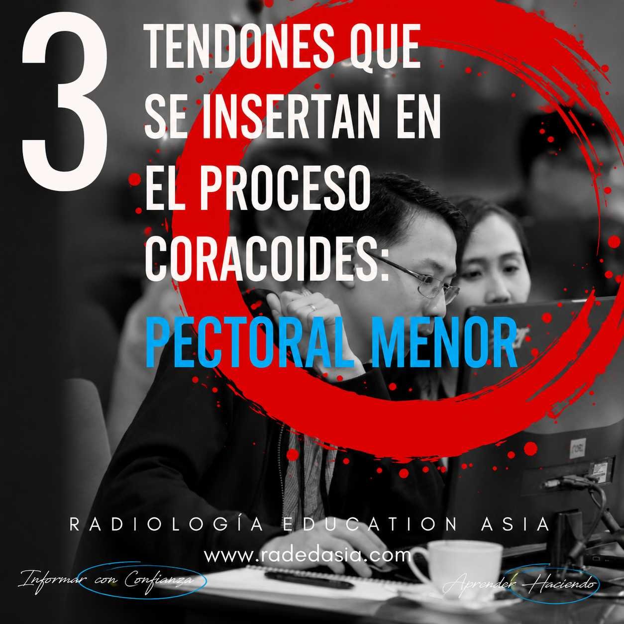 Inserciones tendinosas de la apófisis coracoides, incluida la inserción del pectoral menor y los principales reparos anatómicos.
