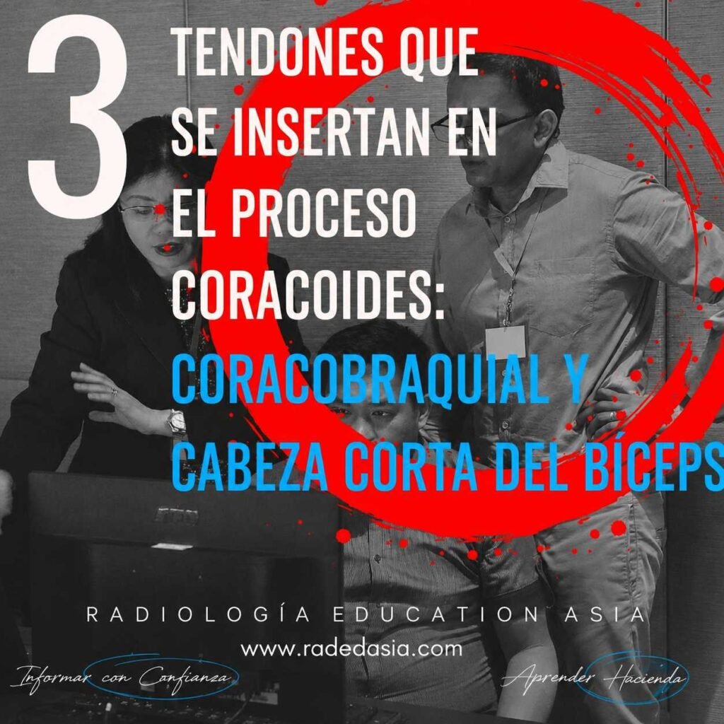 Inserción en la apófisis coracoides del tendón conjunto formado por el coracobraquial y la cabeza corta del bíceps braquial.