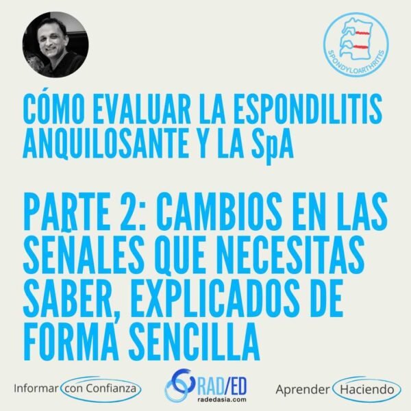 Cambios de señal en RM en la espondilitis anquilosante y la espondiloartritis axial, destacando los principales hallazgos inflamatorios y estructurales.